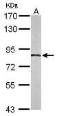 Anti-APPL1 antibody [C1C3] used in Western Blot (WB). GTX115787