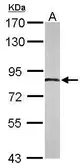 Anti-APPL1 antibody [C1C3] used in Western Blot (WB). GTX115787