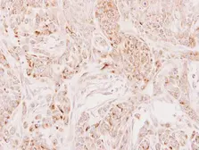 Anti-DECR2 antibody used in IHC (Paraffin sections) (IHC-P). GTX115788