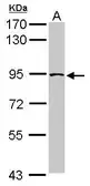 Anti-TRPC4AP antibody [N1N3] used in Western Blot (WB). GTX115795