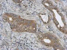 Anti-PITPNC1 antibody used in IHC (Paraffin sections) (IHC-P). GTX115802