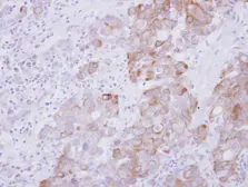 Anti-ARL5A antibody used in IHC (Paraffin sections) (IHC-P). GTX115803