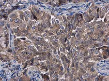 Anti-KLHL3 antibody [N1C1] used in IHC (Paraffin sections) (IHC-P). GTX115809