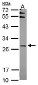 Anti-FBXO6 antibody used in Western Blot (WB). GTX115813