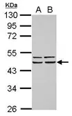 Anti-FBXO4 antibody used in Western Blot (WB). GTX115815
