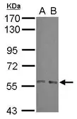 Anti-ARFGAP3 antibody [N1N2], N-term used in Western Blot (WB). GTX115819