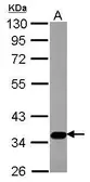 Anti-SLC17A5 antibody used in Western Blot (WB). GTX115822