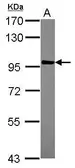 Anti-AKAP8L antibody [N1N3] used in Western Blot (WB). GTX115831
