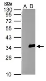 Anti-TZFP antibody used in Western Blot (WB). GTX115832