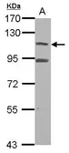 Anti-MTBP antibody [C2C3], C-term used in Western Blot (WB). GTX115838