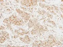 Anti-CLUL1 antibody [N3C3] used in IHC (Paraffin sections) (IHC-P). GTX115840