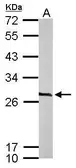 Anti-CacyBP antibody [N1C3] used in Western Blot (WB). GTX115841