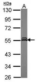 Anti-VPS4A antibody [N3C3] used in Western Blot (WB). GTX115852
