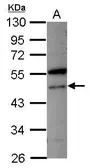 Anti-VPS4A antibody [N1C1] used in Western Blot (WB). GTX115853