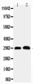 Anti-Aquaporin 5 antibody used in Western Blot (WB). GTX11586