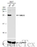 Anti-UBE2S antibody [N1C2] used in Western Blot (WB). GTX115862