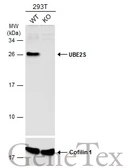 Anti-UBE2S antibody [N1C2] used in Western Blot (WB). GTX115862