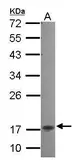 Anti-NKIRAS2 antibody [N1C3] used in Western Blot (WB). GTX115867