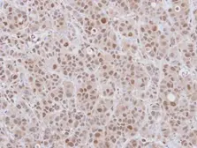 Anti-DCPS antibody [N3C3] used in IHC (Paraffin sections) (IHC-P). GTX115870