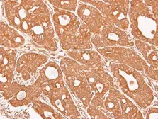 Anti-alpha 3 Catenin antibody [N1N3] used in IHC (Paraffin sections) (IHC-P). GTX115881