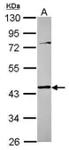 Anti-Tropomodulin 3 antibody used in Western Blot (WB). GTX115885