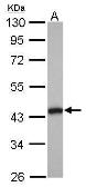 Anti-Tropomodulin 2 antibody [N1C2] used in Western Blot (WB). GTX115886