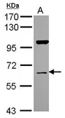 Anti-NRBP1 antibody [N1C1] used in Western Blot (WB). GTX115907