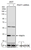 Anti-PSAT1 antibody [N3C3] used in Western Blot (WB). GTX115909
