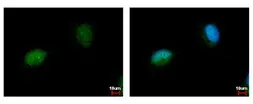 Anti-NARF antibody used in Immunocytochemistry/ Immunofluorescence (ICC/IF). GTX115913
