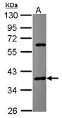 Anti-SPOP antibody [N3C3] used in Western Blot (WB). GTX115917