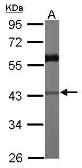 Anti-CARP antibody [N3C3] used in Western Blot (WB). GTX115923