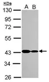 Anti-CARP antibody [N3C3] used in Western Blot (WB). GTX115923