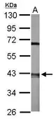 Anti-Arp2 antibody [C1C3] used in Western Blot (WB). GTX115936