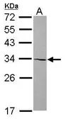 Anti-AMMECR1 antibody used in Western Blot (WB). GTX115945