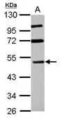 Anti-RASSF8 antibody used in Western Blot (WB). GTX115947