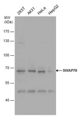 Anti-SWAP70 antibody [N1N3] used in Western Blot (WB). GTX115951