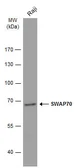 Anti-SWAP70 antibody [N1N3] used in Western Blot (WB). GTX115951