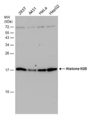 Anti-Histone H2B antibody used in Western Blot (WB). GTX115955