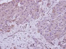 Anti-NARG1 antibody [C2C3], C-term used in IHC (Paraffin sections) (IHC-P). GTX115958