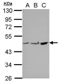 Anti-PPME1 antibody used in Western Blot (WB). GTX115970