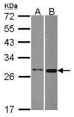 Anti-MTHFS antibody [N1C3] used in Western Blot (WB). GTX115971
