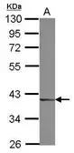 Anti-DCPS antibody used in Western Blot (WB). GTX115973
