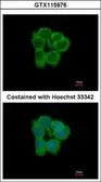 Anti-NMT2 antibody used in Immunocytochemistry/ Immunofluorescence (ICC/IF). GTX115976