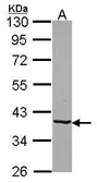 Anti-B4GALT4 antibody [N2C3] used in Western Blot (WB). GTX115980