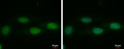 Anti-DNMT3L antibody [N1C1] used in Immunocytochemistry/ Immunofluorescence (ICC/IF). GTX115985