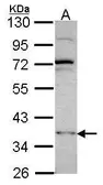 Anti-DNMT3L antibody [N1C1] used in Western Blot (WB). GTX115985