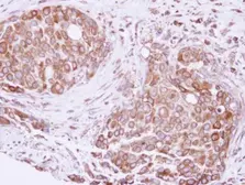 Anti-ATE1 antibody [C1C3] used in IHC (Paraffin sections) (IHC-P). GTX115990