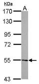 Anti-ATE1 antibody [C1C3] used in Western Blot (WB). GTX115990