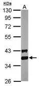 Anti-GAPDHS antibody used in Western Blot (WB). GTX116000