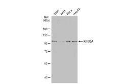 Anti-KIF20A antibody used in Western Blot (WB). GTX116003